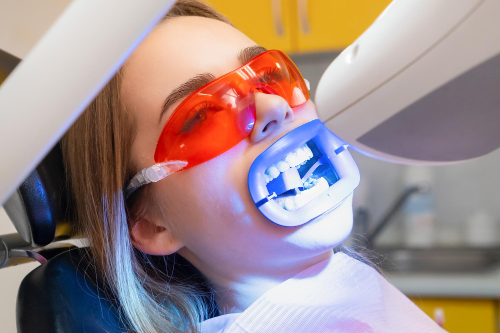 Teeth Whitening Green Valley, AZ
